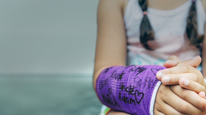 Girl with purple cast